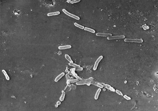 This scanning electron microscope image made available by the Centers for Disease Control and Prevention shows rod-shaped Pseudomonas aeruginosa bacteria. U.S. health officials are advising people to stop using the over-the-counter eye drops, EzriCare Artificial Tears, that have been linked to an outbreak of drug-resistant infections of Pseudomonas aeruginosa. The Centers for Disease Control and Prevention on Wednesday night, Feb. 1, 2023, sent a health alert to physicians, saying the outbreak i