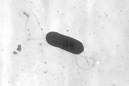 This 2002 electron microscope image made available by the Centers for Disease Control and Prevention shows a Listeria monocytogenes bacterium, responsible for the food borne illness listeriosis. On Wednesday, Nov. 9, 2022, U.S. health officials said at least one death and a pregnancy loss are tied to an outbreak of listeria food poisoning associated with sliced deli meats and cheeses that has sickened 16 people in six states, including 13 who were hospitalized. (Elizabeth White/CDC via AP, File)