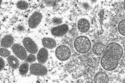 This 2003 electron microscope image made available by the Centers for Disease Control and Prevention shows mature, oval-shaped monkeypox virions, left, and spherical immature virions, right, obtained from a sample of human skin associated with the 2003 prairie dog outbreak. U.S. health officials are expanding the group of people recommended to get vaccinated against the monkeypox virus. They also say they are providing more monkeypox vaccine, working to expand testing, and taking other steps to 
